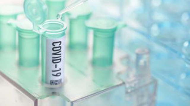 85 души са преминали през ковид кабинетите във Варна